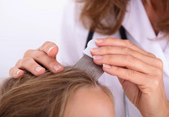 Mädchen mit Läusekamm Läuse behandeln ohne Fehler reduziert die Ansteckungsgefahr